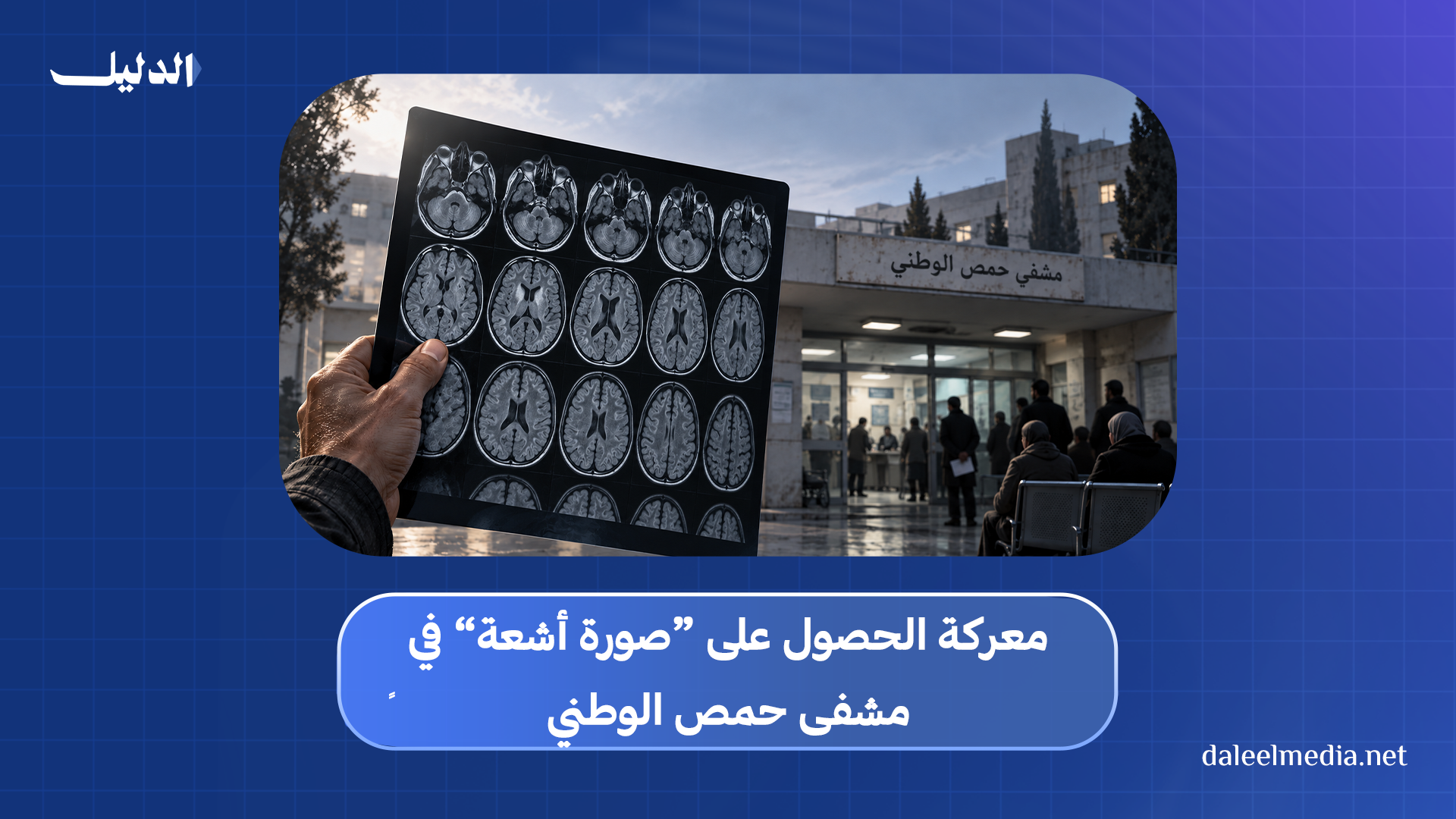 صورة أشعة - حمص